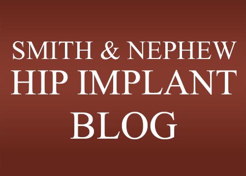 Smith & Nephew Hip Implant News Blog